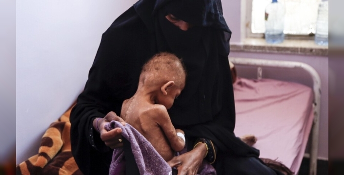 BM'den Yemen'de 18 milyondan fazla insanın şiddetli açlık çektiği uyarısı